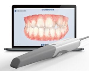 AoralScan Digitalni otisak stomatoloska ordinacija maja cvetkovic