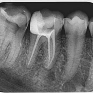 Dentalni radiogram 2800c136ad 1 500 stomatoloska ordinacija maja cvetkovic