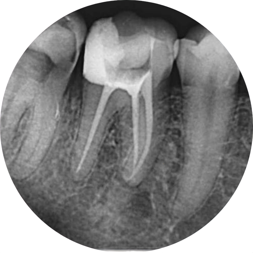 Snimak zuba 500 round transformed stomatoloska ordinacija maja cvetkovic
